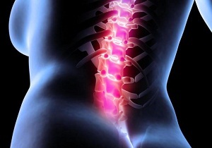 causes de la douleur dans le dos